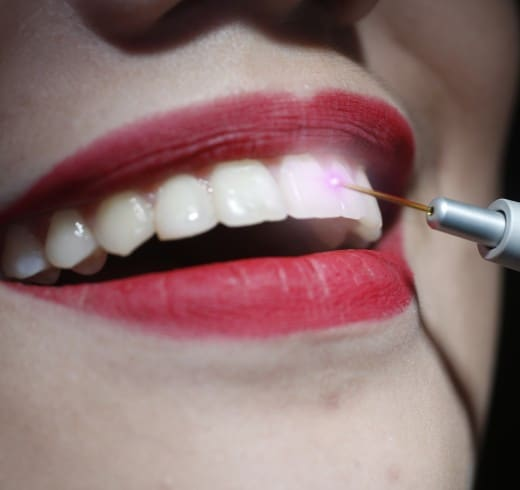 A woman receiving laser dentistry at a dental clinic