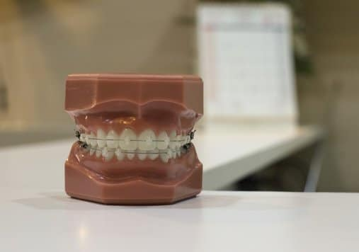 A mould of teeth sitting on a desk in a dental office