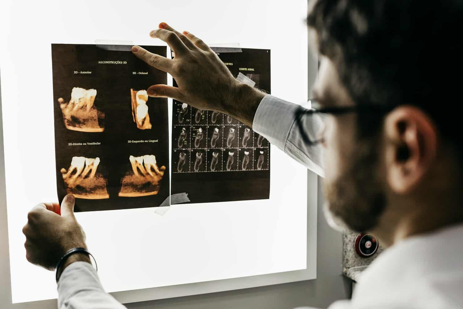 A dentist reviewing dental x rays