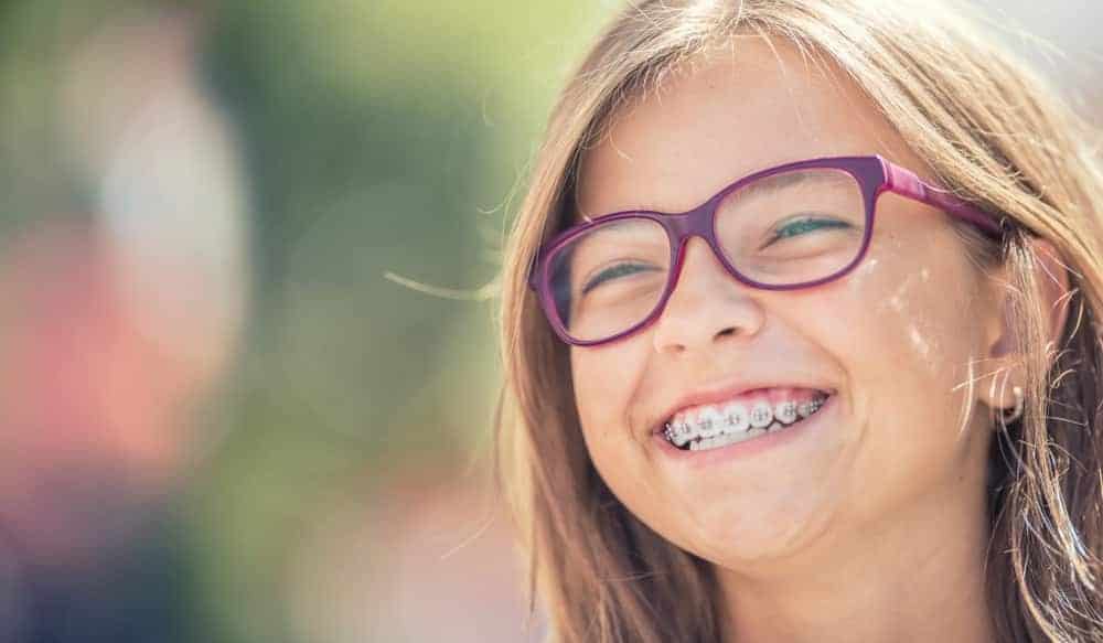 How Much Do Braces Cost?