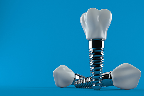Dental Implants ready to be used