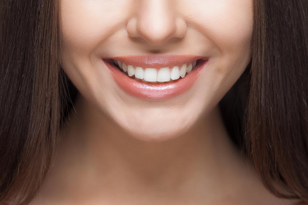 Woman With Aligned Teeth